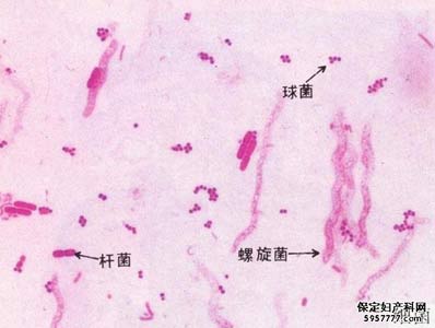 大理治疗阴道炎医院